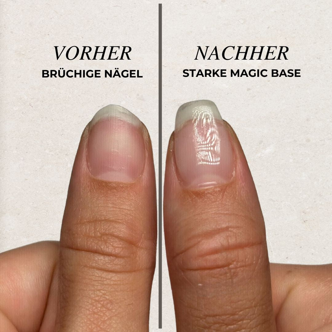 Magic Base - einzeln