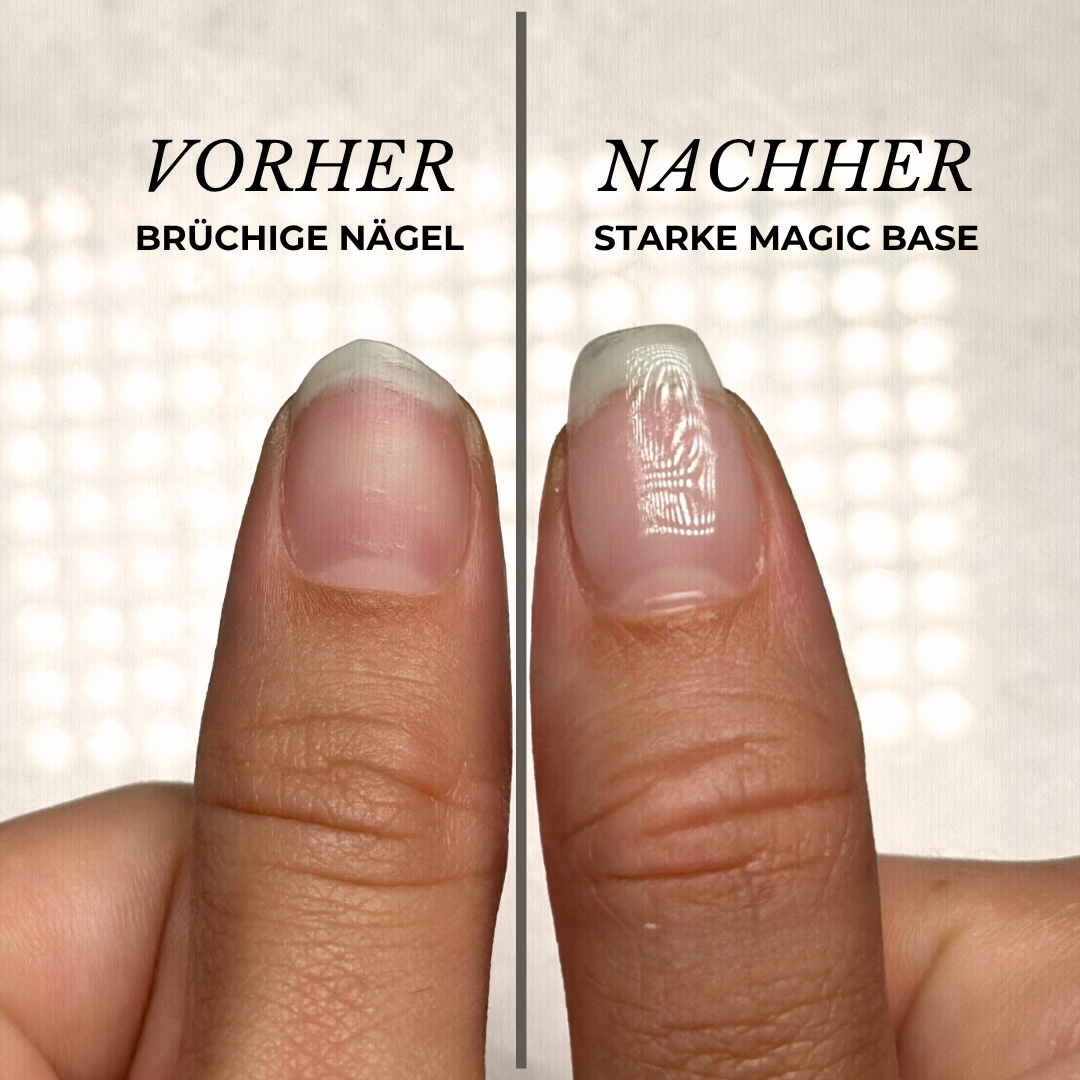 Magic Base - starter set for strong & healthy nails!