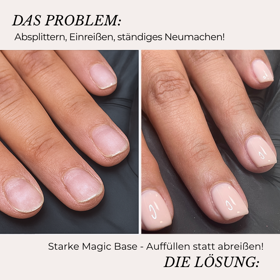 Magic Base Set – dein Start zu starken Nägeln