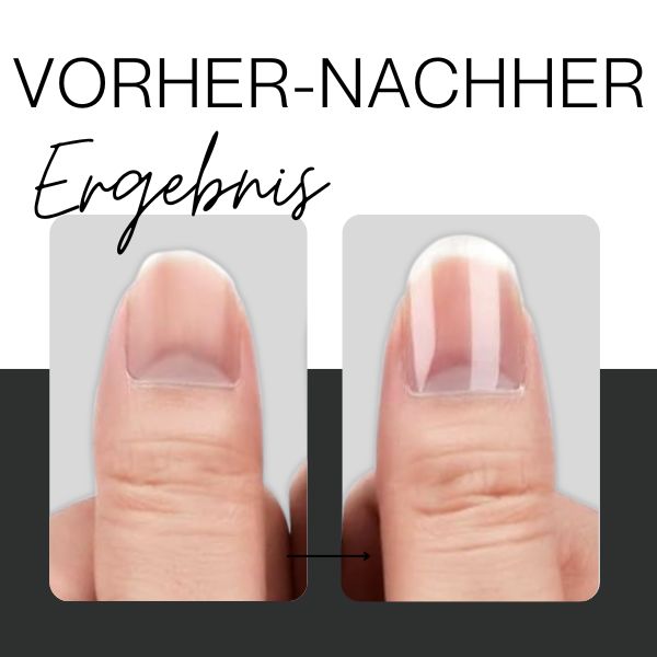 Ultra Nagelhärter